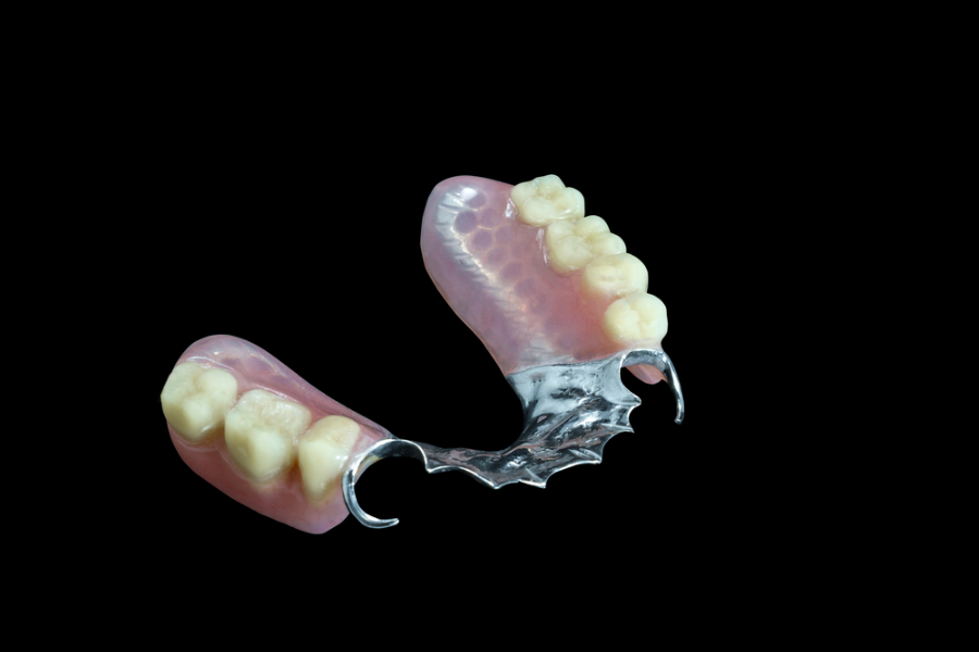 Prosthesis and occlusion