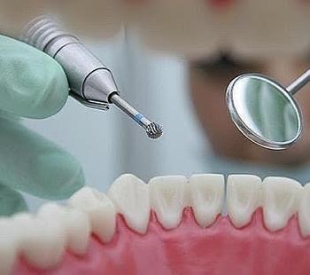 Las bacterias causantes de la periodontitis tambin aumentan el riesgo de cncer de esfago.